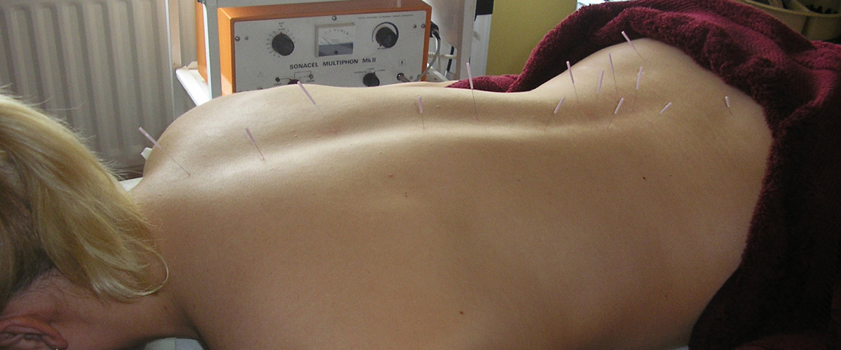 Medical Acupuncture